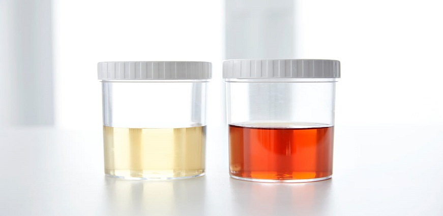 The Ins and Outs of Synthetic Pee: What You Need to Know